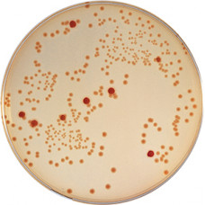 Escherichia coli O157 Analizi